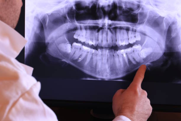 Best Emergency Dental Care for Broken or Chipped Teeth in Blue Ridge, GA