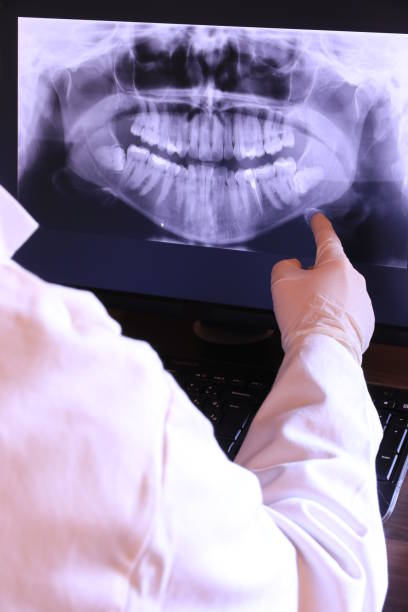 Best Emergency Gum Treatment in Blue Ridge, GA